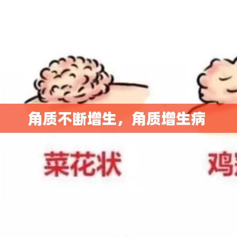 角质不断增生，角质增生病 