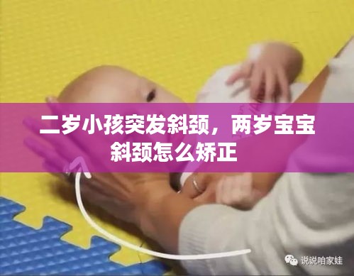 二岁小孩突发斜颈，两岁宝宝斜颈怎么矫正 